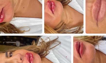 OVAdermoesthetic : Institut de beauté à Choisy-le-Roi