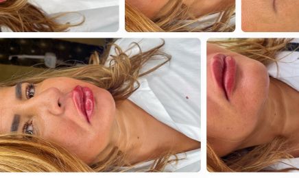 OVAdermoesthetic : Institut de beauté à Choisy-le-Roi