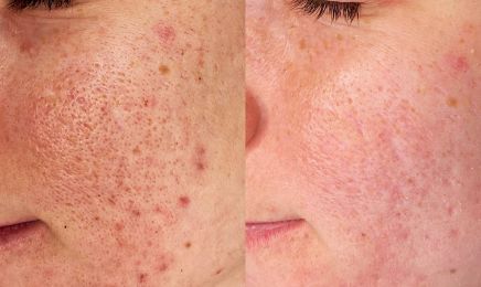 PURE Aesthetics : Institut de beauté à Montpellier