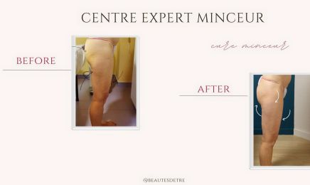 Beautés d’Être – Centre Expert Minceur, Électrolyse, Anti-âge & massages : Manucure à La Tour-du-Pin