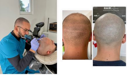 Hairpigma Tricopigmentation Rouen : Manucure à Le Petit-Quevilly