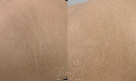 Beauty by Bodda : Institut de beauté à Toulouse