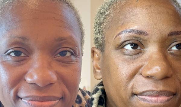 LM Dermopigmentation Réparatrice 