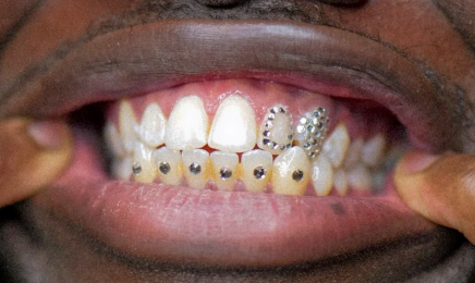 Dealeuse de gems - Grillz & Strass dentaire : Manucure à Rennes