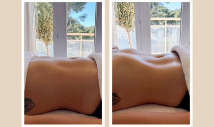 Stim wellness | Drainage lymphatique Renata Franca : Institut de beauté à Saint-Pée-sur-Nivelle