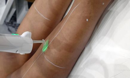 Centre NEPHRA Laser and Beauty - Epilation définitive,Laser Médical Clarity 2 - Infirmière : Institut de beauté à Saint-Denis