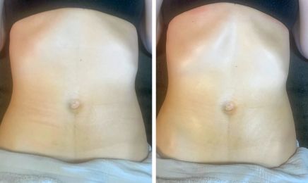 Kania Esthetique & Massage - Drainage lymphatique Renata Franca  : Institut de beauté à Marseille