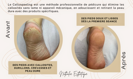 NATHALIE ESTHETIQUE : Institut de beauté à Montpellier