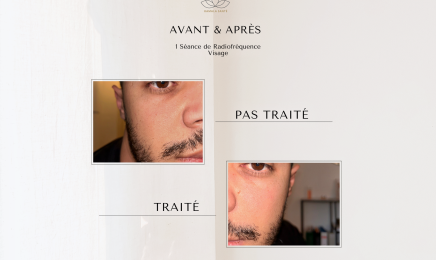 Equilibre Minceur : Institut de beauté à Nîmes