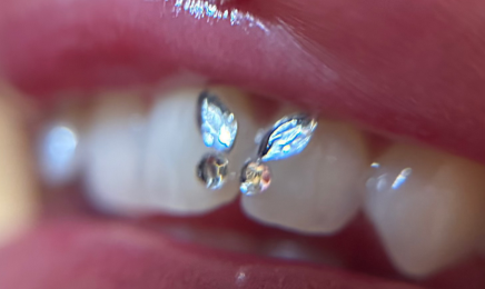 ENFANTS TERRIBLES - Tâches de Rousseur - Piercing - Strass Dentaire  : Institut de beauté à Marseille
