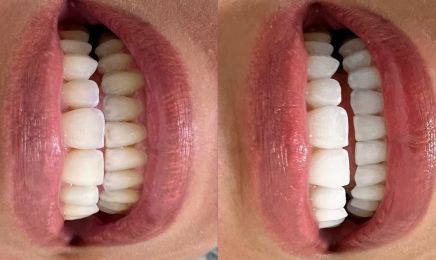 Beauty Glow  : Manucure à Compiègne