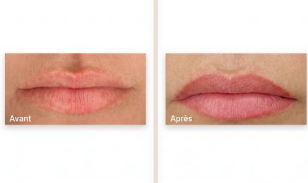 Magali Coquatrix : Institut de beauté à Saint-Germain-en-Laye