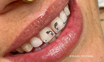 BELATYZIA (STRASS DENTAIRE - TACHES DE ROUSSEURS & SHADING) : Institut de beauté à Eysines