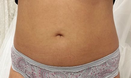 Peretti Angelique Coaching privé - Fitness : Institut de beauté à Ajaccio