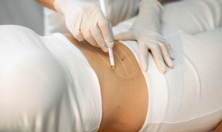 Femme - Medical Health & Aesthetics: Kosmetikstudio in Ingolstadt