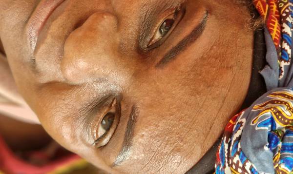 LM Dermopigmentation Réparatrice 