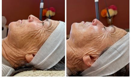 Cabinet Sentè • Soin du visage | Radiofréquence | INDIBA | Minceur | Hydrafacial : Coiffeur à Granville