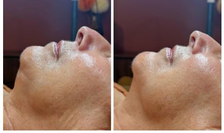Cabinet Sentè • Soin du visage | Radiofréquence | INDIBA | Minceur | Hydrafacial : Coiffeur à Granville