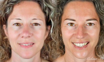 L'atelier dermo-esthétique by Melissa Melki : Institut de beauté à Nieul-sur-Mer