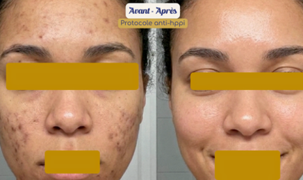 Melaskinxcare - Skin thérapeute & Esthéticienne experte peaux noires  : Institut de beauté à Villejuif