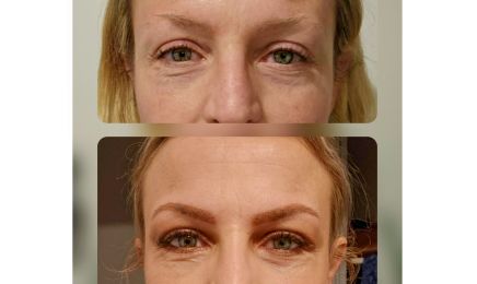Studio Beauty & Brow - Épilation Laser : Institut de beauté à Montpellier