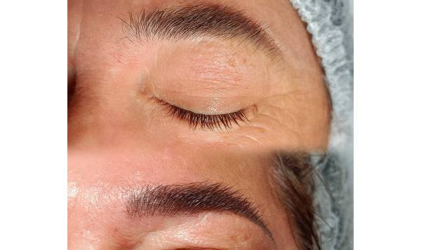 Studio Beauty & Brow - Épilation Laser