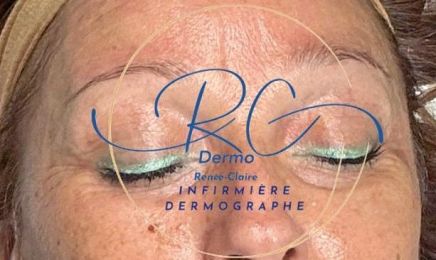 RC Dermo - Infirmière Dermographe : Coiffeur à Metz