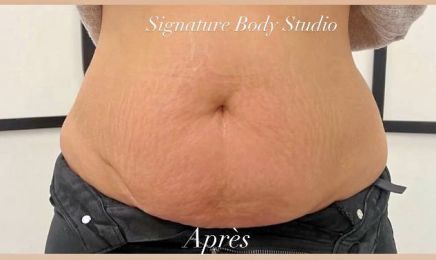 Signature Body Studio : Institut de beauté à Grenoble