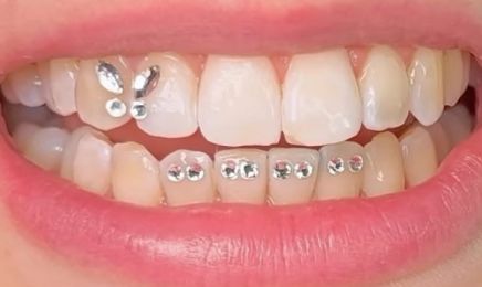 TrvNails & Strass Dentaire  : Manucure à Rennes