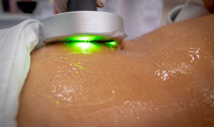 Ebruli beauty - Épilation définitive & Soins minceur | Alès  : Institut de beauté à Alès