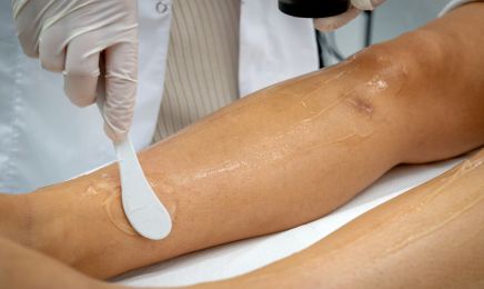 Ebruli beauty - Épilation définitive & Soins minceur | Alès  : Institut de beauté à Alès
