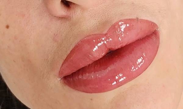 Dermobeauty esthetique 