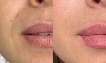 Beautycel : Institut de beauté à Meaux