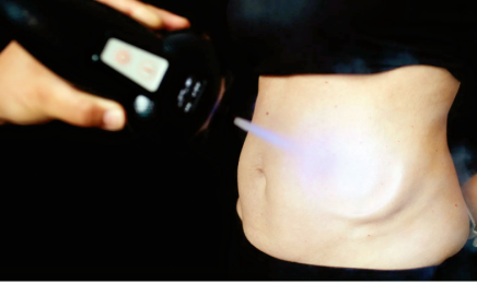 L'Apogée ｜CRYOTHERAPIE, CRYOLIPOLYSE, LIFTING COREEN, MASSAGE SONORE, EMS : Barbier à Péchabou