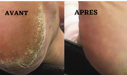Kenze Naturel Piercing et Beauté : Manucure à Tours