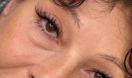 DermaXcellence – Épilation Laser Définitive & Extensions de Cils : Institut de beauté à Belleville