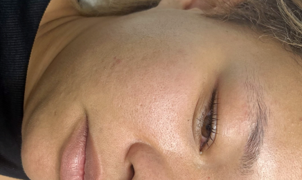 Ebruli beauty - Épilation définitive & Soins minceur | Alès  : Institut de beauté à Alès