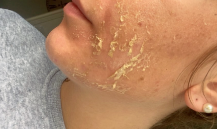 Ebruli beauty - Épilation définitive & Soins minceur | Alès  : Institut de beauté à Alès