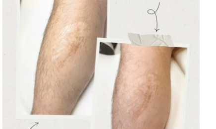 AUREA DERMOGRAPHIE : Institut de beauté à Roncq