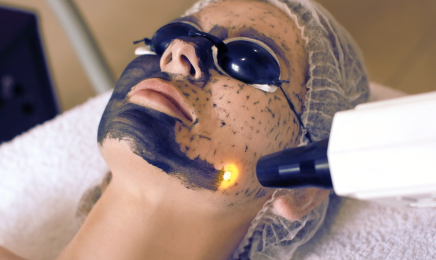 Depil N’Care ® - Centre d'épilation définitive - Laser, Electrolyse & Détatouage : Institut de beauté à Montpellier