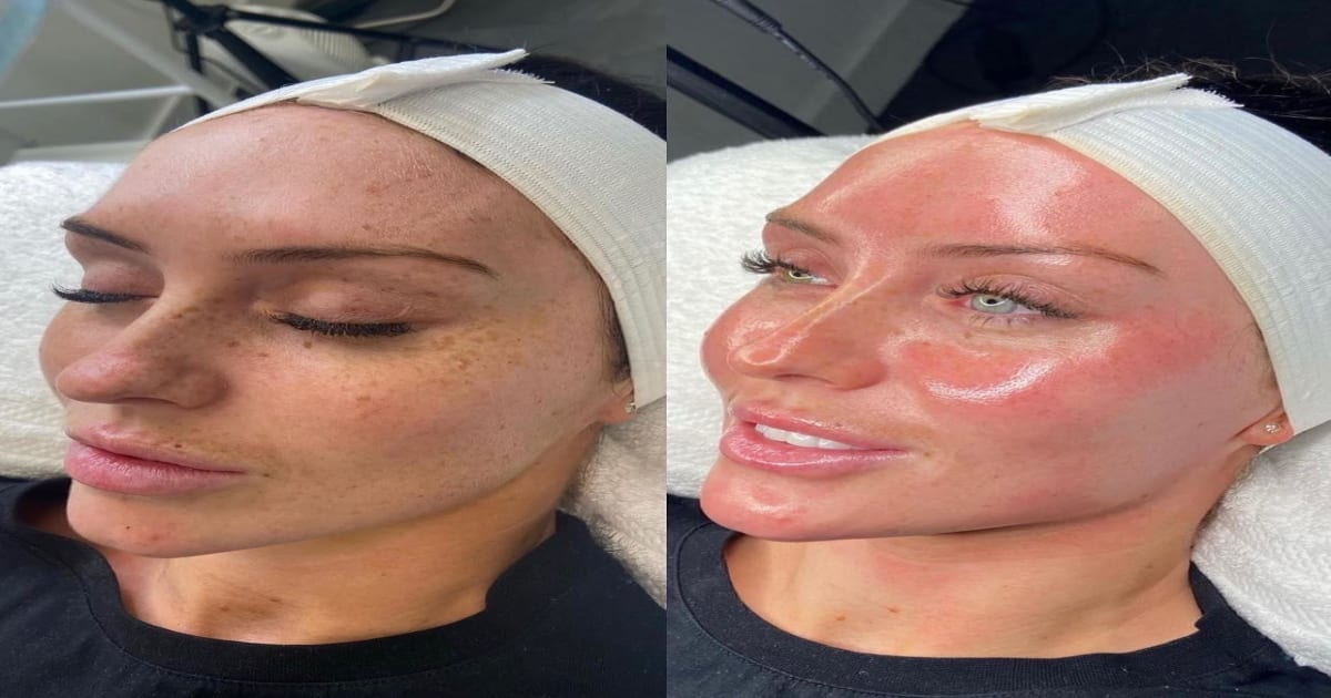 SKINFACE Expert Soin du Visage institut de beauté à Montpellier