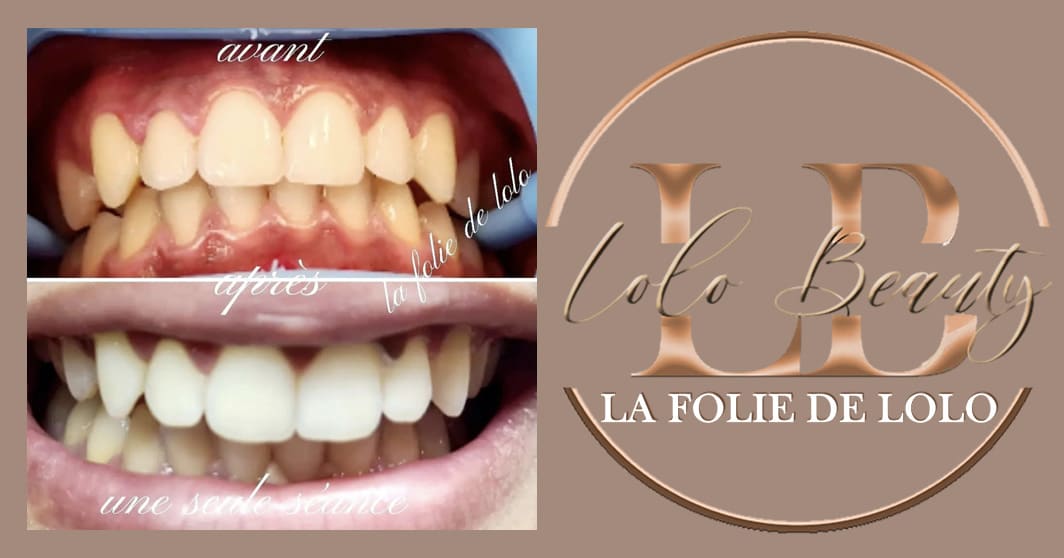 La Folie de Lolo - Sourcils & cils Nice - La Folie de Lolo - Photo Galerie - OneBooking