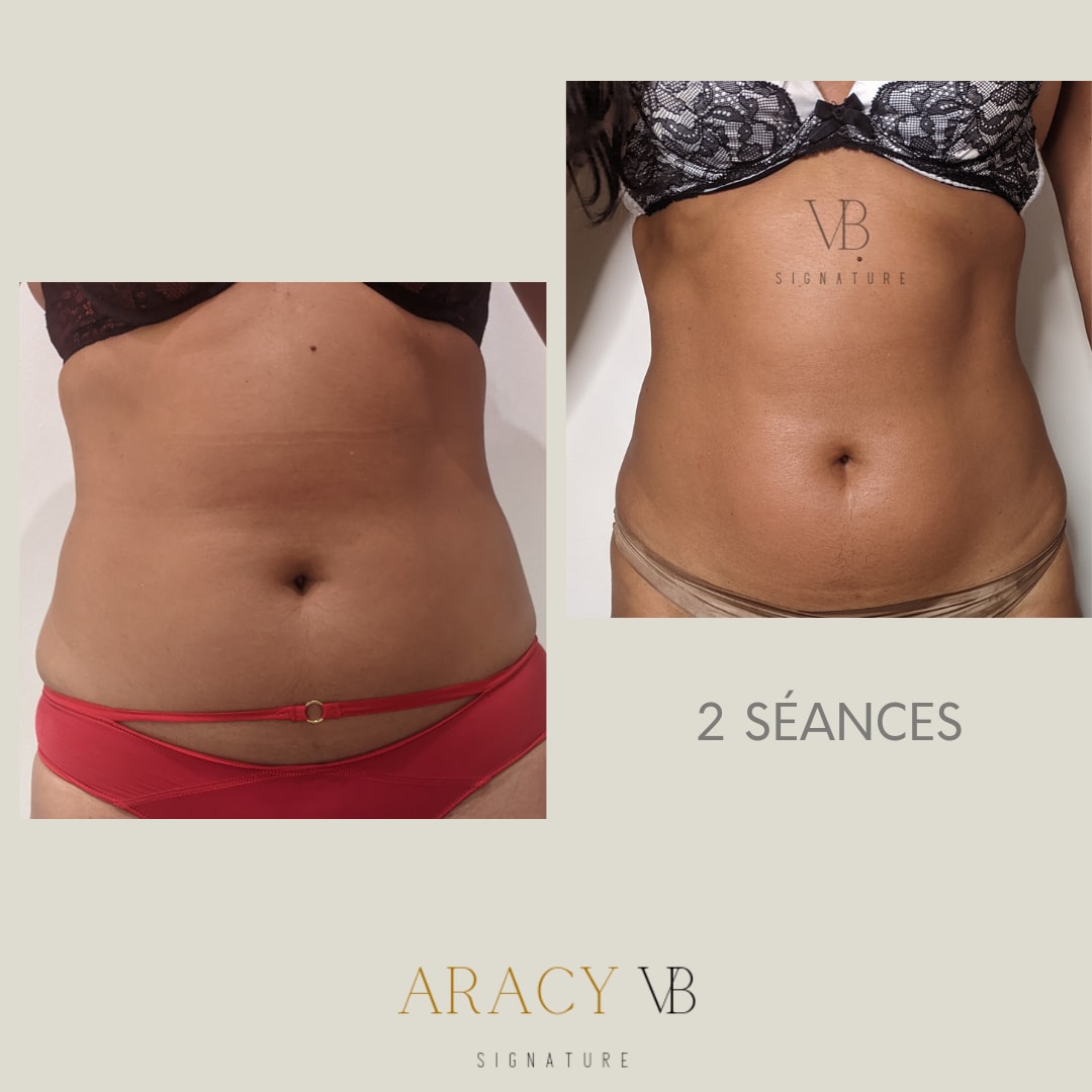 Aracy VB Signature - Onglerie Cannes - Aracy VB Signature - Photo Galerie - OneBooking
