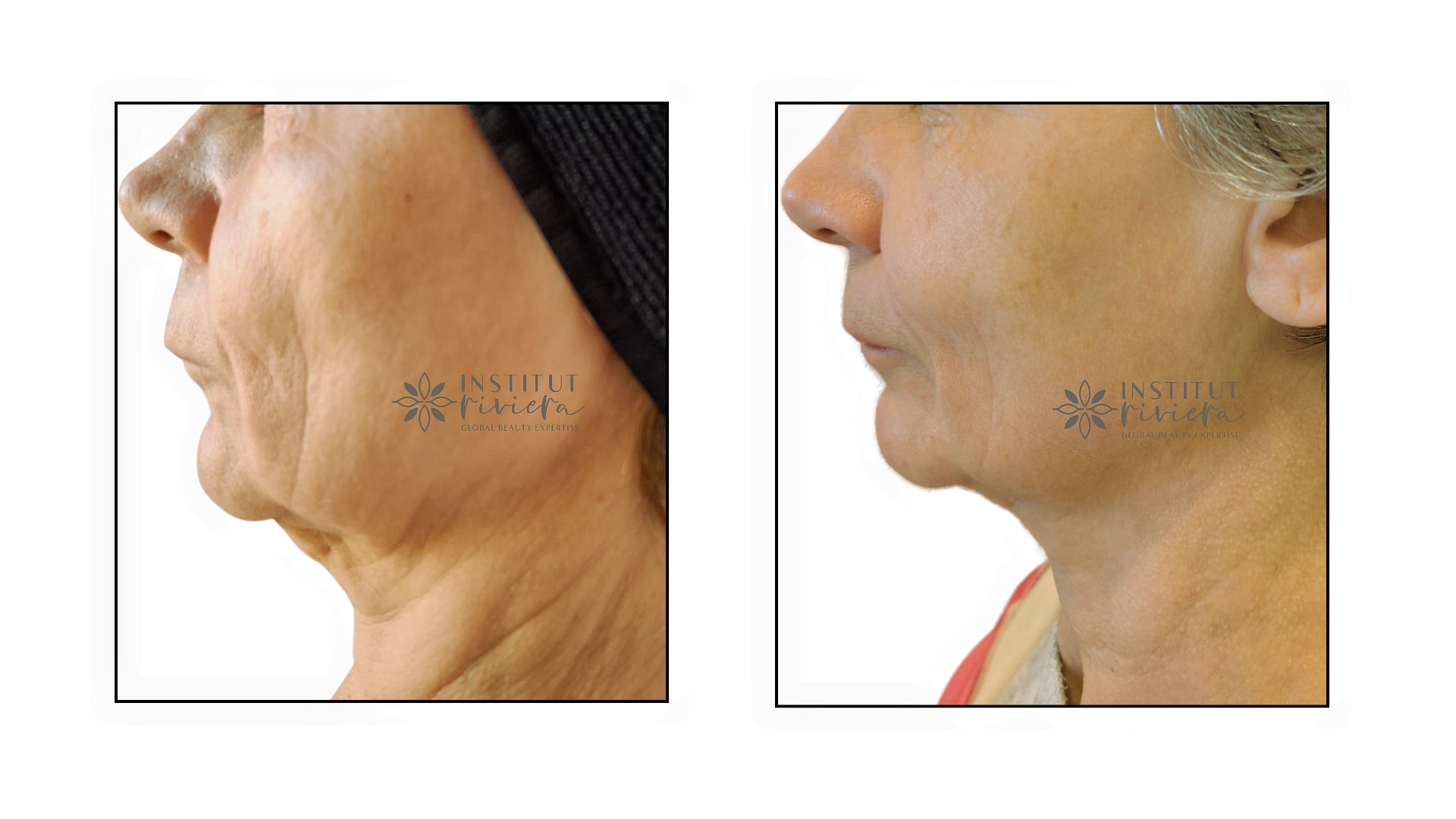 Institut Riviera | Expertise Epilation Définitive Electrolyse, Anti Age et Minceur - Institut de beauté Antibes - Institut Riviera | Expertise Epilation Définitive Electrolyse, Anti Age et Minceur - Photo Galerie - OneBooking
