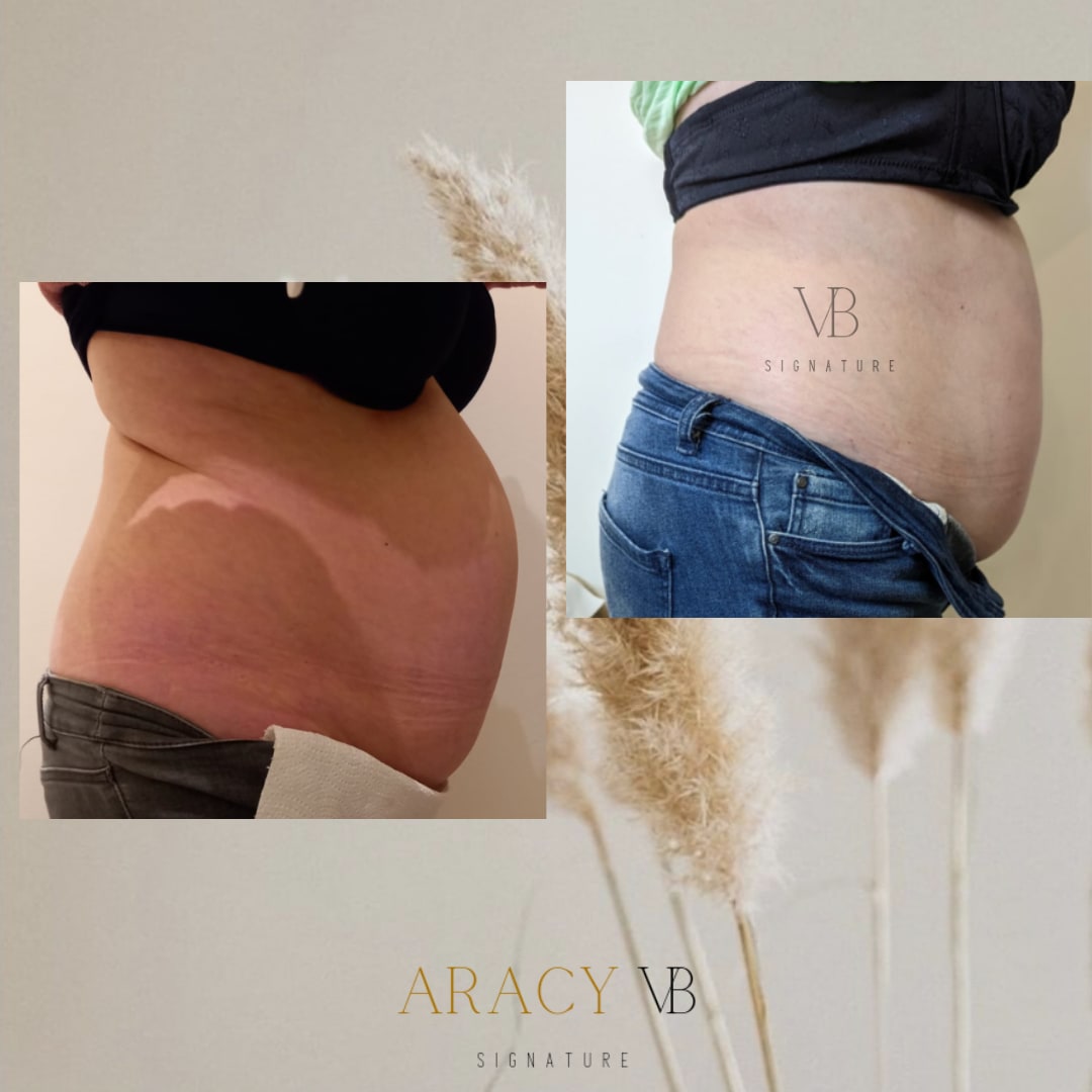 Aracy VB Signature - Onglerie Cannes - Aracy VB Signature - Photo Galerie - OneBooking