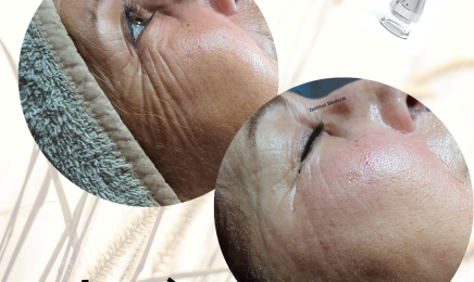 Bioderm : Manucure à Perpignan