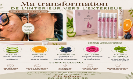 L'Institut Ella Baché : Manucure à Colombes