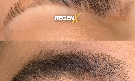 Fano Dermo - RegenX kelen bauck : Institut de beauté à Cancale