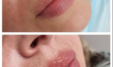 Dermobeauty esthetique  : Institut de beauté à Les Pennes-Mirabeau