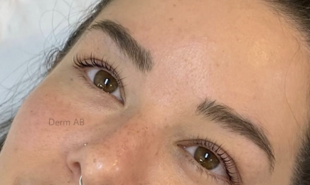 Derm AB  : Institut de beauté à Nice